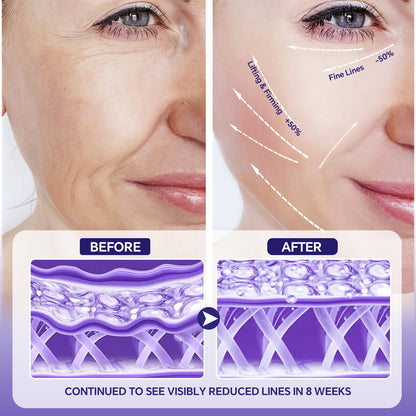 Beliface Peptides Serum: Anti-Aging, Smooth Fine Lines & Wrinkles, Boost Collagen & Hydrate—Hyaluronic Acid—Fragrance-Free—1.35Fl.Oz